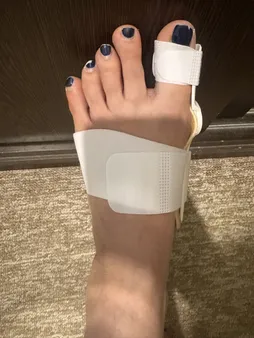 اسپیلنت اصلاح کننده شست پا مدل LSJ - 6