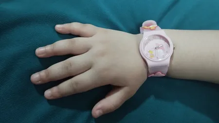 ساعت مچی عقربه ای بچگانه مدل بند سیلیکونی ضد حساسیت طرح خرگوش