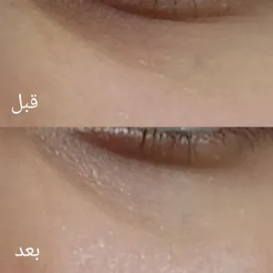 تجریه خرید کرم دور چشم رزالیا مدل Rosa Active حجم 20 میلی لیتر