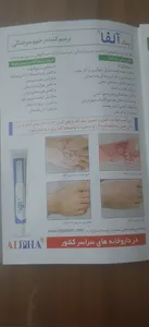 تجریه خرید کرم ترمیم کننده رژودرم مدل الفا وزن  ۵۵گرمی