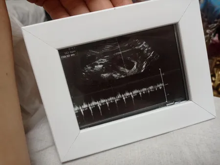 قاب عکس مدل 215 مجموعه 3 عددی