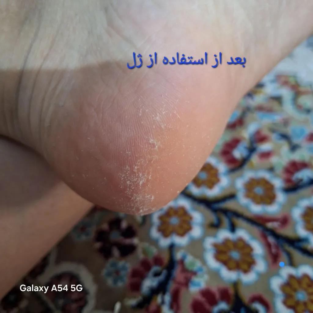 ژل پینه بردار لی بیوتی مدل 01 حجم 250 میلی لیتر