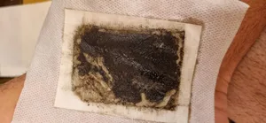 تجریه خرید پد دفع سموم بدن کینوکی مدل mp-913 بسته 10 عددی