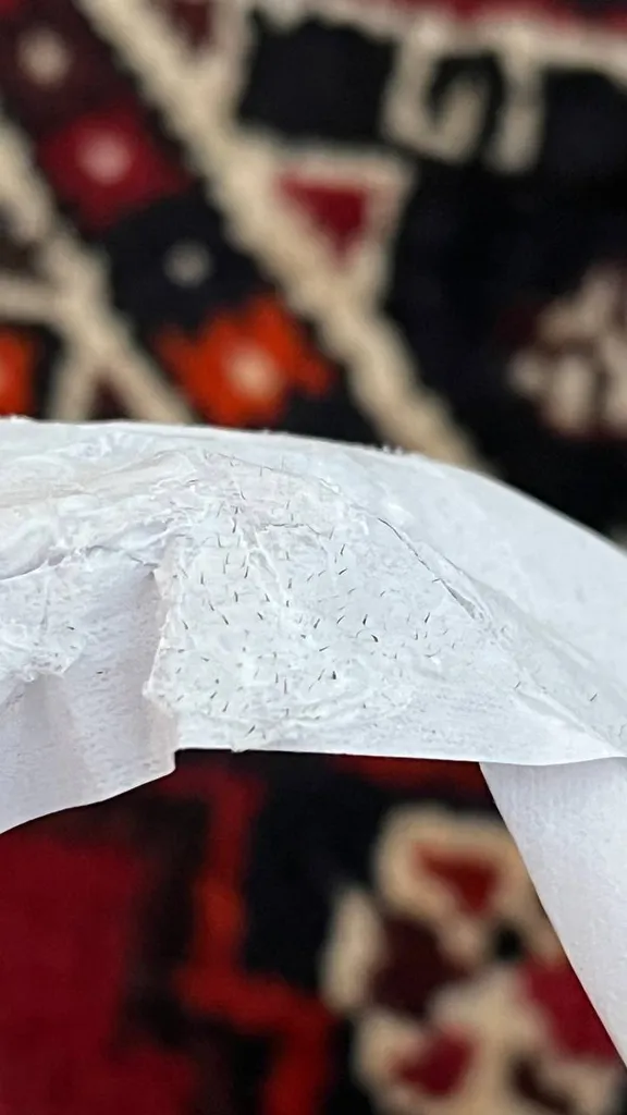 ماسک بینی لنبنا مدل سر سیاه مناسب انواع پوست وزن 30 گرم