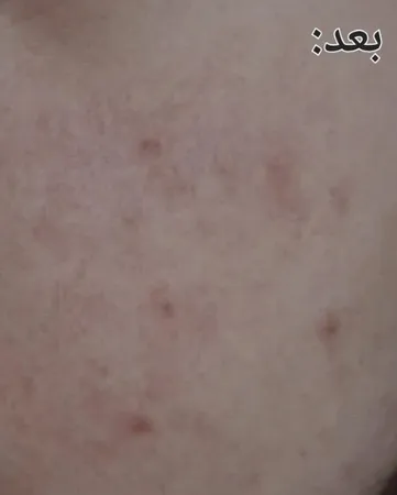 سرم ضد لک ویتالیر مدل آربوتین حجم 30 میلی لیتر