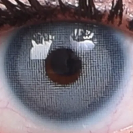 لنز چشم هرا مدل B رنگ آبی