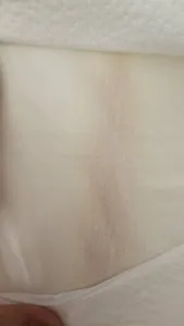 تجریه خرید بالش طبی های-تک مدل  MF100L