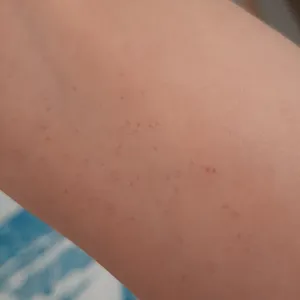 تجریه خرید کرم مرطوب‌کننده و نرم‌کننده هیدرودرم مدل Aqua Satin حجم 500 میلی‌لیتر