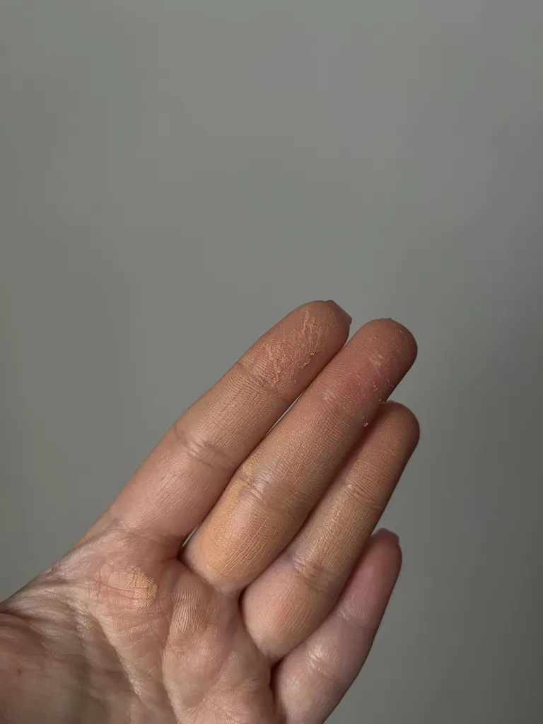 فلوئید ضد جوش سین بیونیم مدل Medacnyl_L1 حجم 40 میلی لیتر