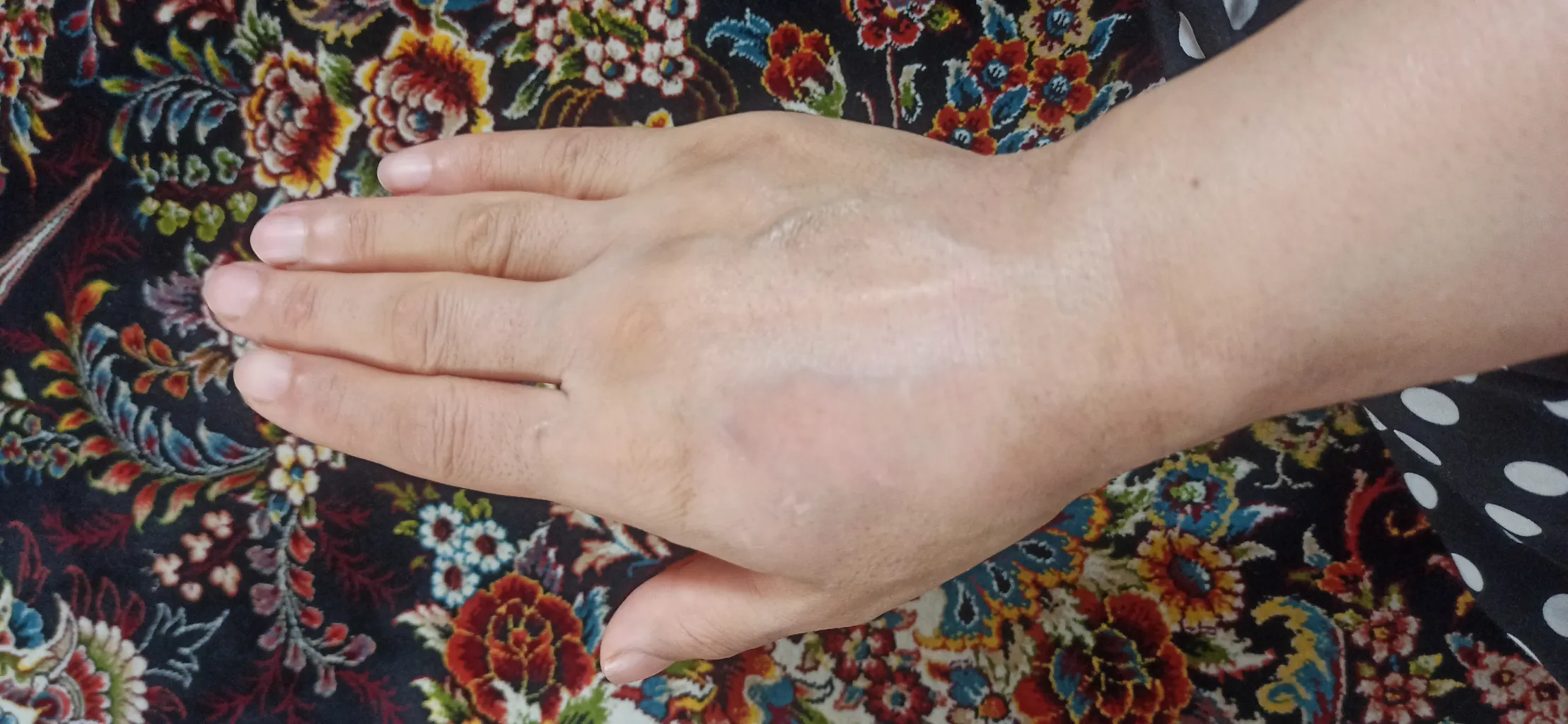 کرم ترمیم کننده لیدی رویال مدل 002 حجم‌ 30 میلی لیتر