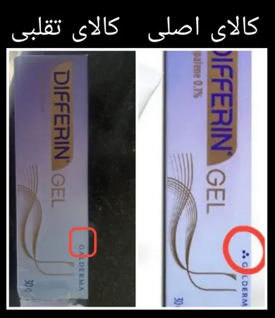 ژل ضد جوش دیفرین مدل Adapalene حجم 30 میلی لیتر