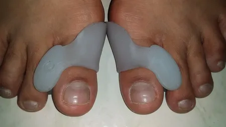 پد فاصله دهنده انگشت شصت پا مدل A30 بسته 2 عددی