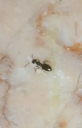 ژل مورچه کش برسودا مدل َA25 وزن 25 گرم