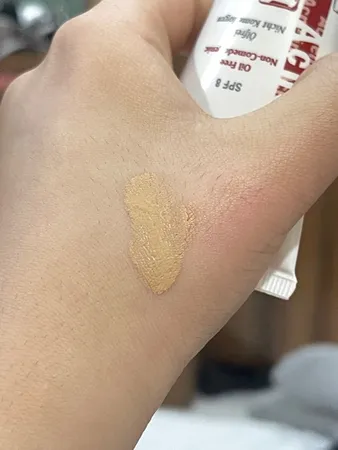 کرم پودر آکنه تیوبی مای مدل Acneline A02 حجم 35 میلی لیتر