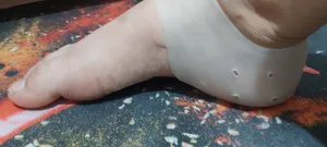 تجریه خرید پد خارپاشنه اسپنکو ژل مدل F1