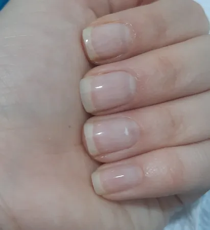 محلول محرک رشد ناخن هیدرودرم کد 01 حجم 8 میلی لیتر