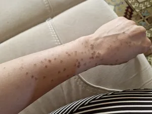 تجریه خرید کرم ترمیم کننده پوست لافارر مدل سوکرانیکا حجم 30 میلی لیتر