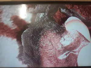 تجریه خرید ماسک صورت رینو زیت مدل Black mask carbon active حجم 75 میلی لیتر مجموعه 2 عددی