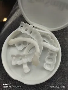 تجریه خرید لمینت متحرک دندان ترواسمایل کد 09