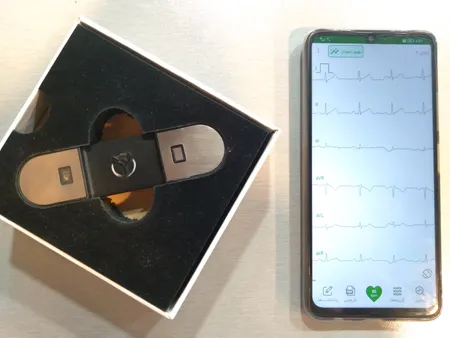 دستگاه ثبت نوار قلب نبض آوا مدل NH1- Handheld