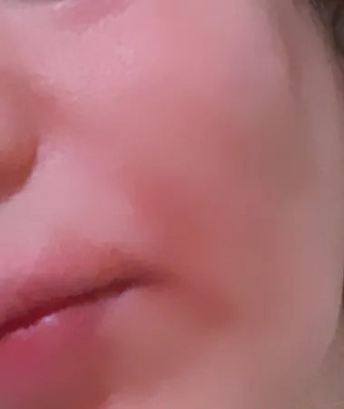 کرم روشن کننده ویتامین C سینره حجم 40 میلی لیتر