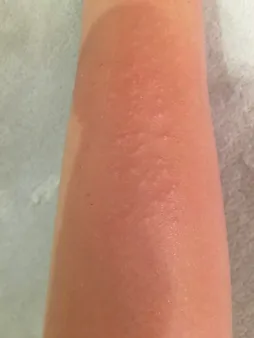 کرم موبر بدن ویت مخصوص پوست معمولی 100 میلی لیتر