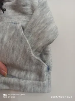 روکش دنده مدل هودی