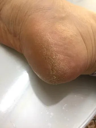 سوهان و رنده پا هلنا مدل M621