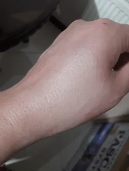 کرم پودر آکنه تیوبی مای مدل Acneline A02 حجم 35 میلی لیتر