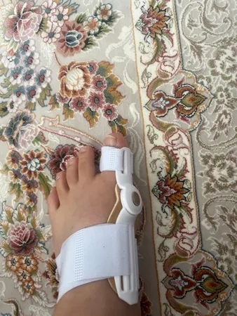 اصلاح کننده انگشت پا مدل HV