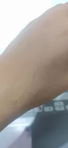 تجریه خرید کرم ضد جوش درمالوگ مدل BR حجم 30 میلی لیتر