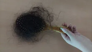 تجریه خرید فولیکوژن اروند فارمد بسته 60 عددی