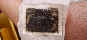 تجریه خرید پد دفع سموم بدن کینوکی مدل mp-913 بسته 10 عددی