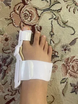 اسپیلنت اصلاح کننده شست پا مدل LSJ - 6