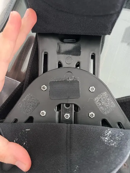 کمربند طبی اورتینو مدل TLSO