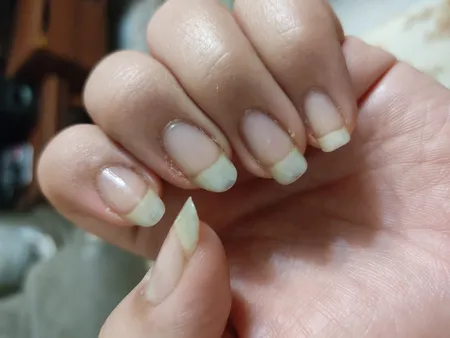 محلول محرک رشد ناخن هیدرودرم کد 01 حجم 8 میلی لیتر