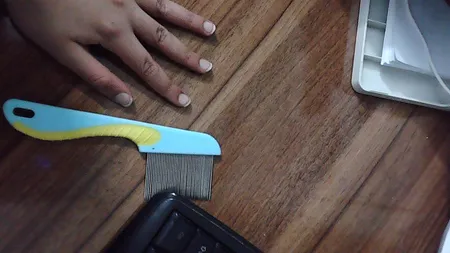 شانه ضد شپش مدل SS1