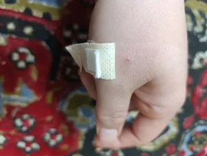 تجریه خرید چسب زخم مدیکس مدل Antiallergic بسته 100 عددی