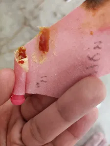 تجریه خرید شمع پاکسازی گوش اوندیان مدل X6 مجموعه 12 عددی