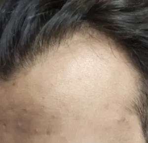 تجریه خرید روغن رویش مو تیزگل مدل mix حجم 50 میلی لیتر