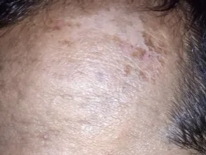 تجریه خرید اسکراب لایه بردار پوست مکس لیدی مدل گل رز حجم 300 میلی لیتر