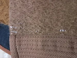 تجریه خرید کلیه بند طبی آذر اکس مدل چسبی