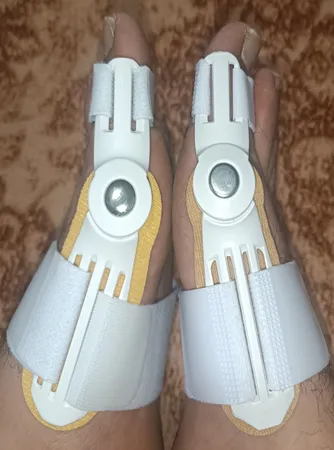 اسپیلنت اصلاح کننده شست پا مدل LSJ - 6