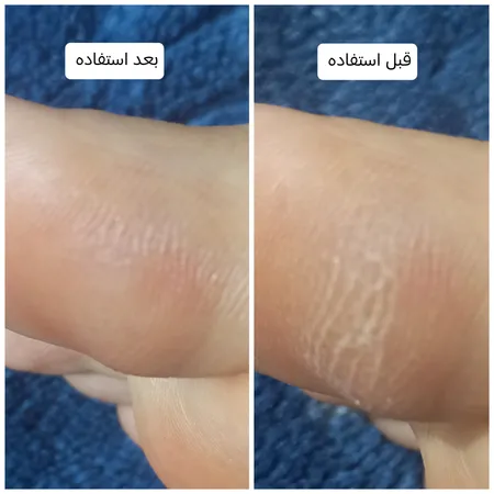 بالم رفع ترک پوست رتیرو مدل bombshell victoria secret حجم 17 میلی لیتر