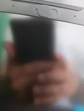 تجریه خرید کاور لنز دوربین رینیکا مدل CC03 بسته 3 عددی