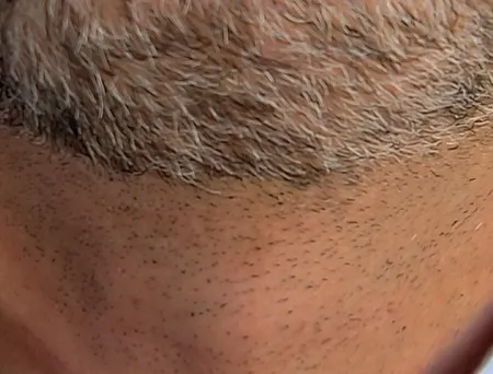 ماشین اصلاح موی سر و صورت شارژی کیمی مدل KM-2269