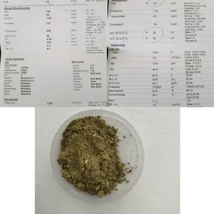 تجریه خرید دمنوش چربی کبد و پاکسازی کبد تیزگل - 250 گرم