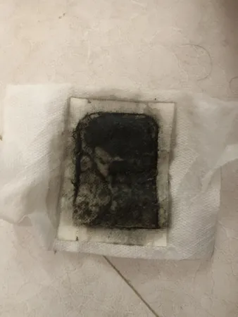 پد دفع سموم بدن کینوکی مدل mp-913 بسته 10 عددی