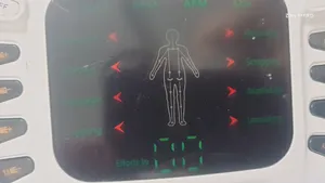 تجریه خرید تنس عضلانی مدل ST111