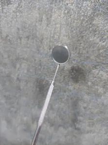 تجریه خرید آینه دندانپزشکی مدل V-4477